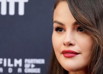Expone Selena Gomez su rostro al natural con un brote de acné