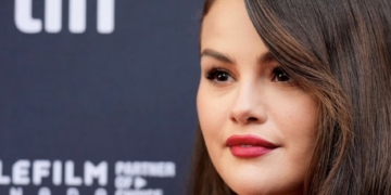 Expone Selena Gomez su rostro al natural con un brote de acné