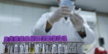 Reciben tratamiento gratuito más de 6 mil tabasqueños con VIH